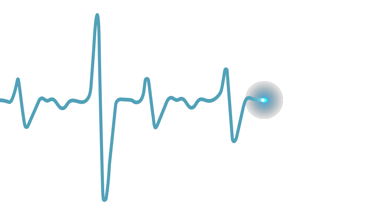 EKG graphic